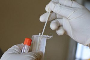 COVID cases hit 200